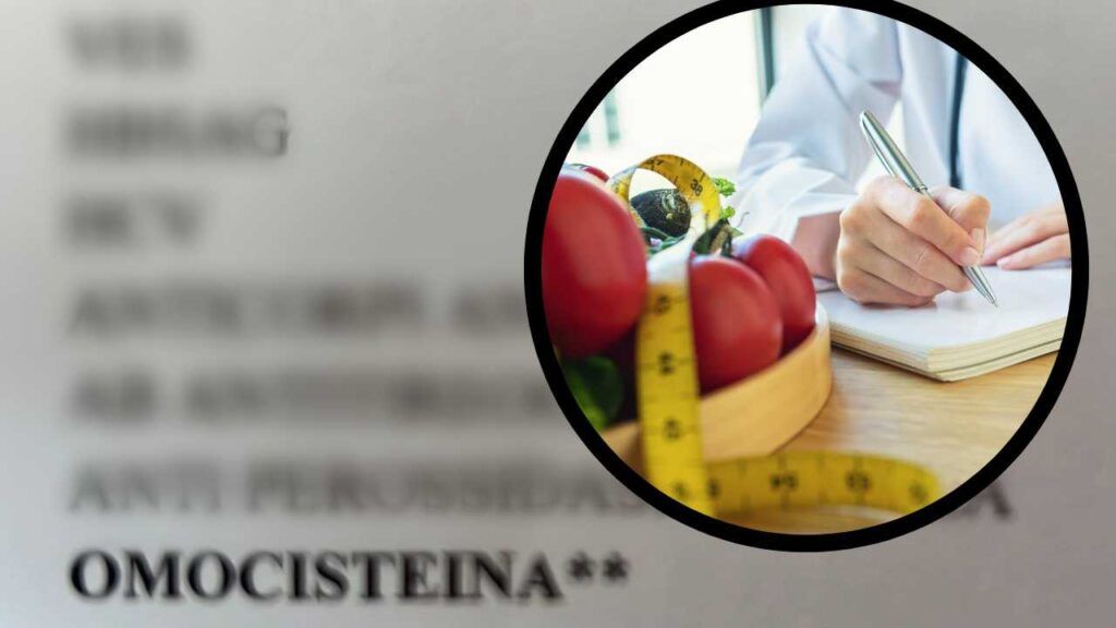 Omocisteina Alta | Come Scoprirla E Cosa Mangiare - RicettaSprint.it