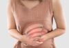 Come curare la sindrome dell'intestino irritabile senza farmaci