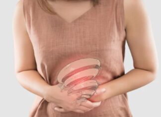 Come curare la sindrome dell'intestino irritabile senza farmaci