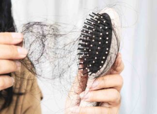 Capelli in caduta libera, ecco come fare per evitare il peggio - RicettaSprint